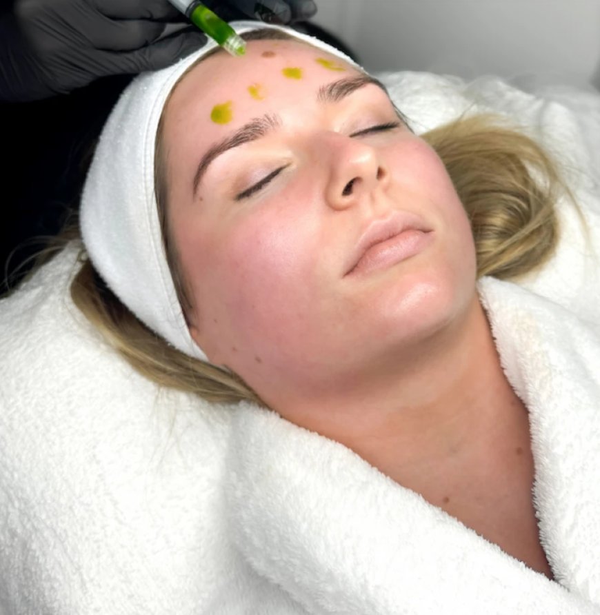 Biorepeel In Manchester: Modern Peel reatment for Smoother-Looking Skin