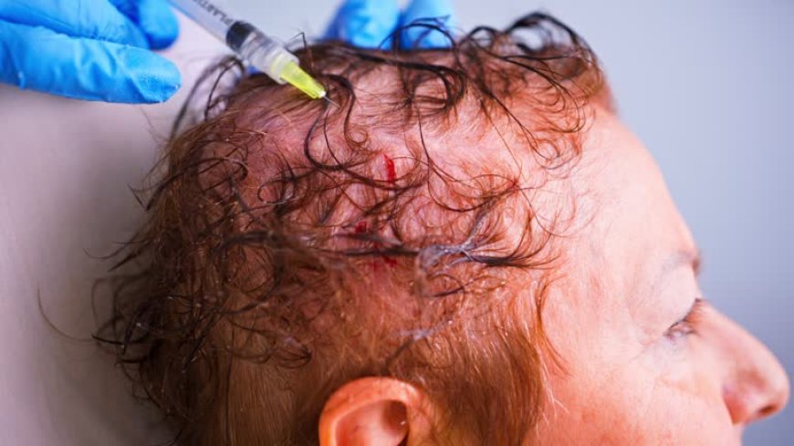 How Does GFC Hair Treatment in Dubai Stimulate Hair Follicles?