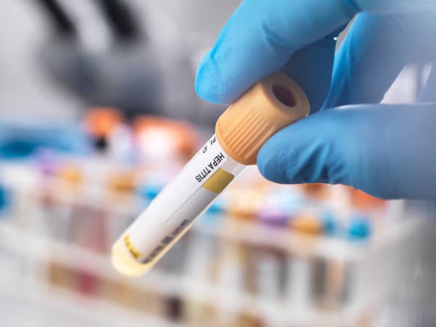 Hepatitis B Screening and Liver Health Awareness