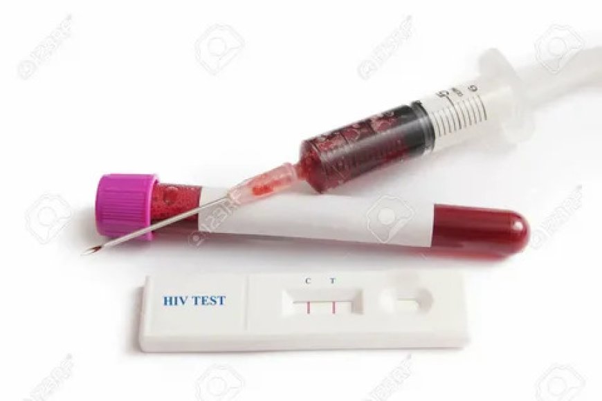 When Should HIV Testing Be Repeated?