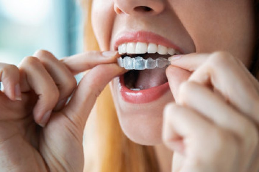 Could clear aligners fit your life better than you think?