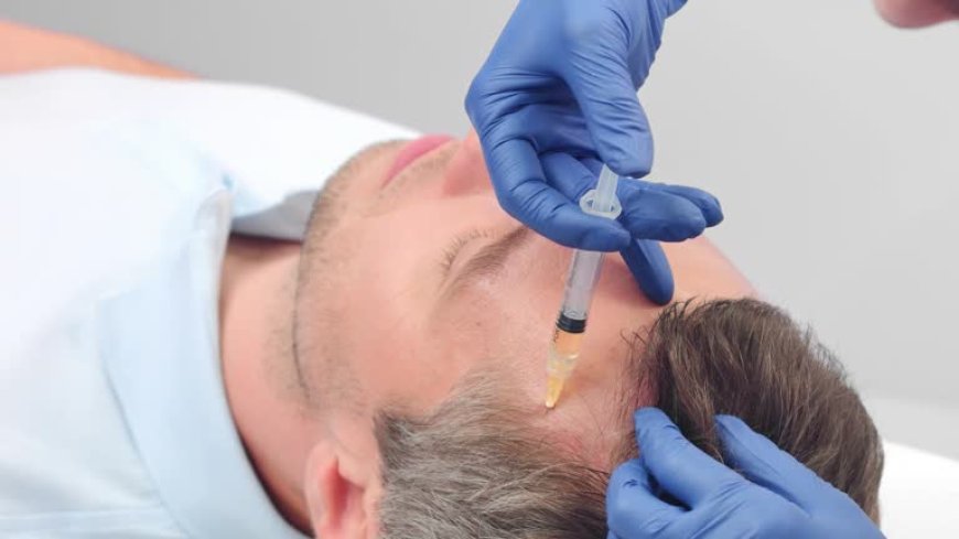 ACell PRP Treatment for Hair in Dubai and Hair Density Changes Over Time