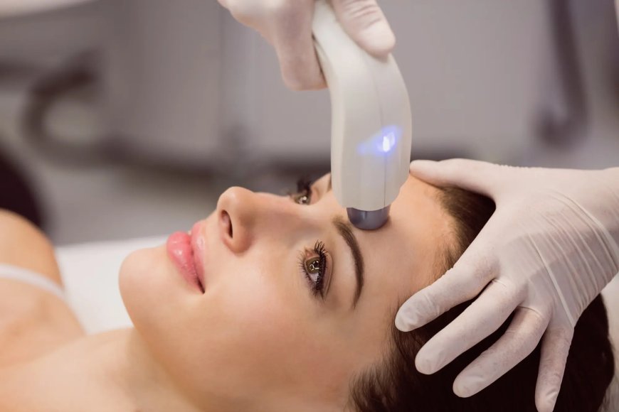 Why Are Multiple Laser Skin Resurfacing Sessions Used?
