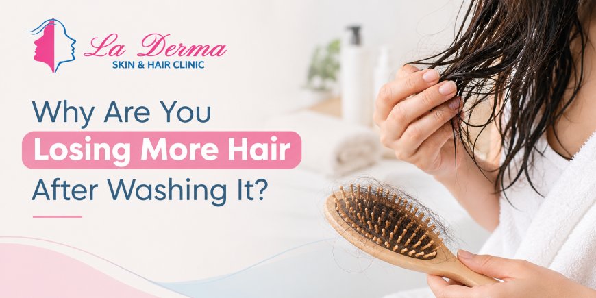 Why Are You Losing More Hair After Washing It?