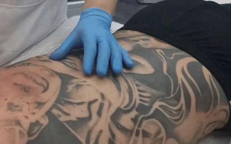 What is Picosure Tattoo Removal Treatment?