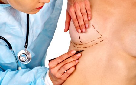 Inverted Nipple Surgery: Understanding Surgical Techniques
