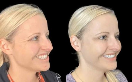 Best Plastic Surgeon in Dubai for Botox: Planning Your Aesthetic Goals