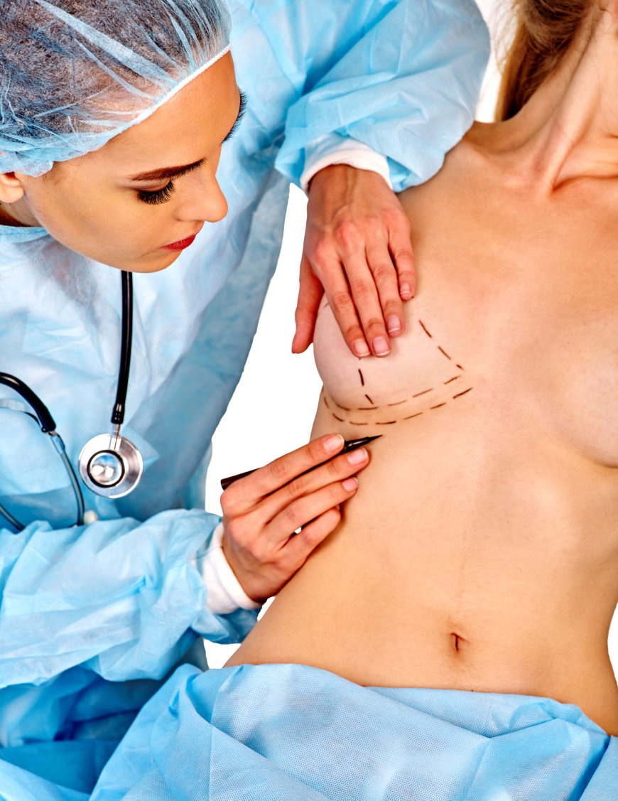 Inverted Nipple Surgery: Understanding Surgical Techniques