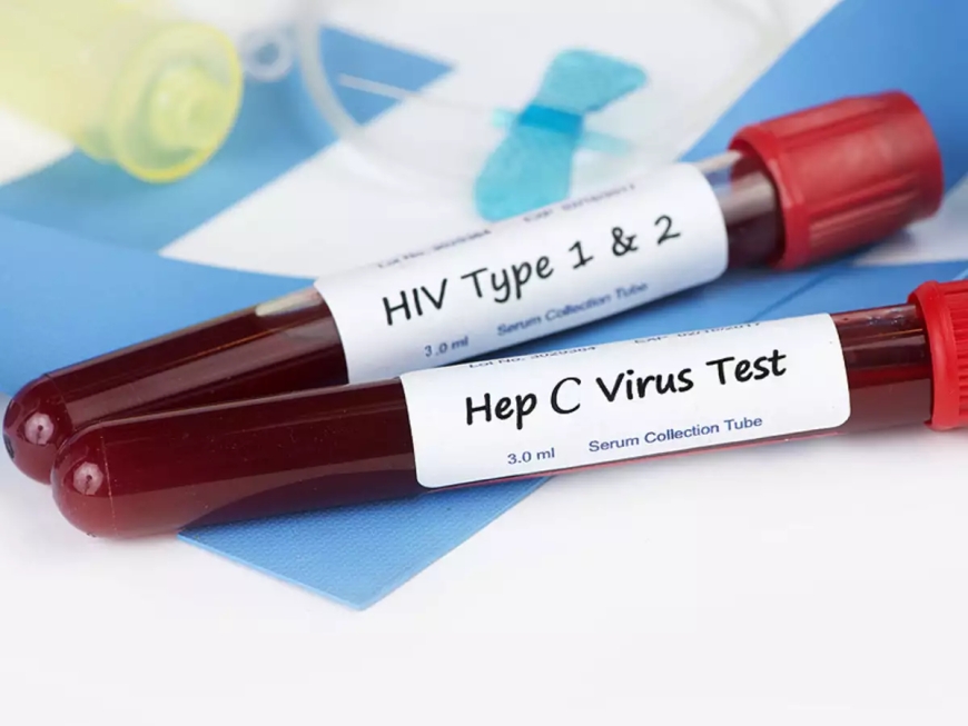 Hepatitis C Testing for People Without Symptoms