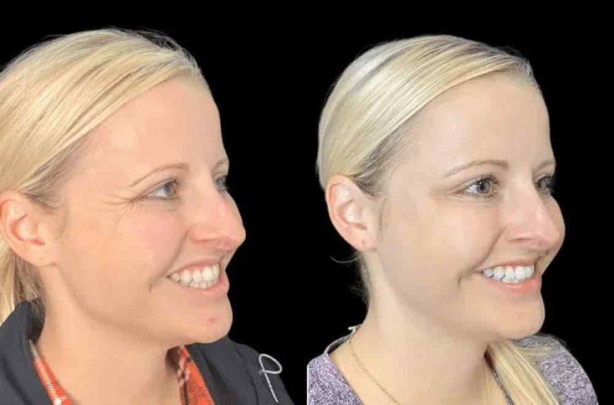 Best Plastic Surgeon in Dubai for Botox: Planning Your Aesthetic Goals